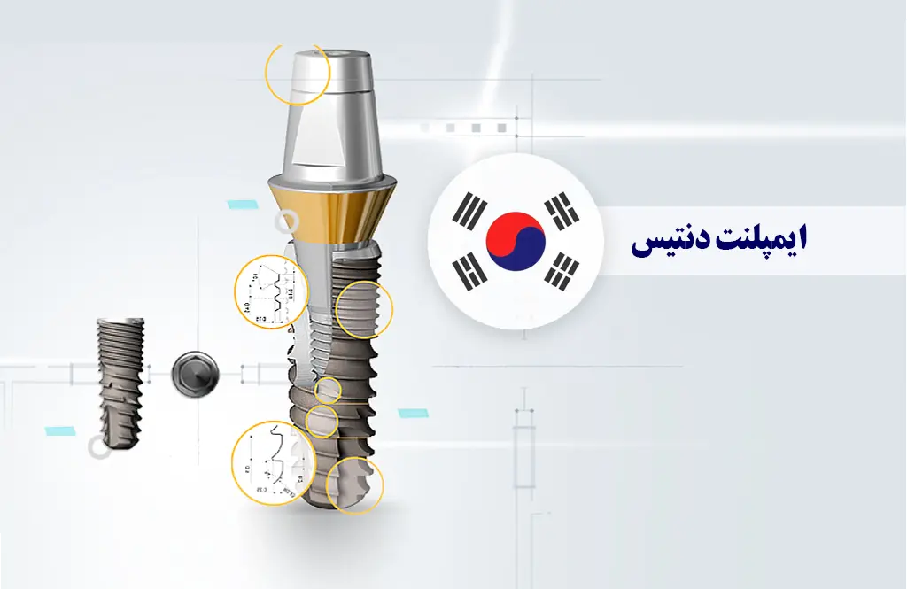 قیمت و مزایای ایمپلنت کره‌ای دنتیس (Dentis) در ایران