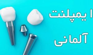 ایمپلنت آلمانی تایالوژیک (Tiologic)، ترکیب دقت مهندسی