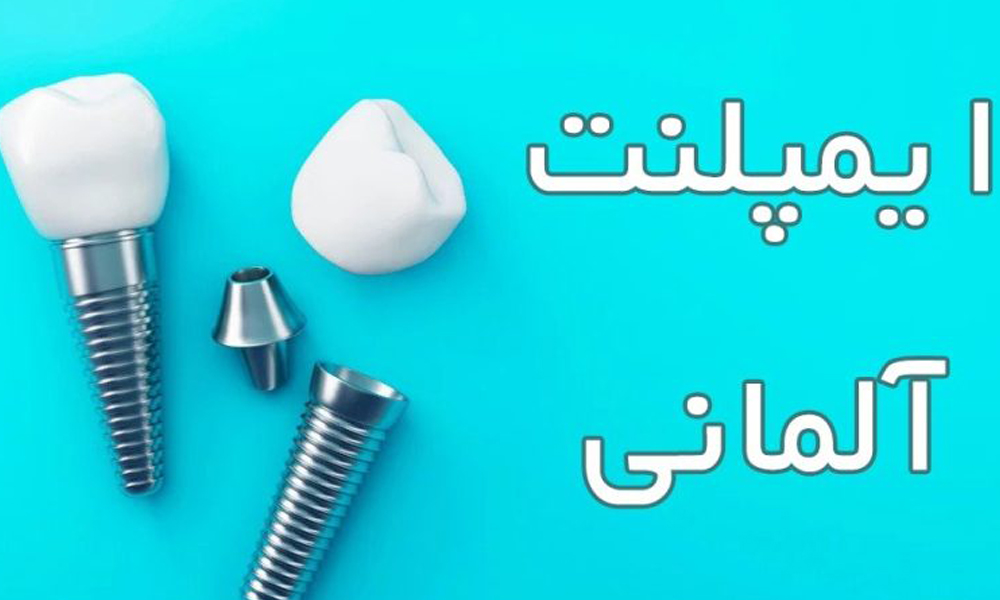 ایمپلنت آلمانی تایالوژیک (Tiologic)، ترکیب دقت مهندسی
