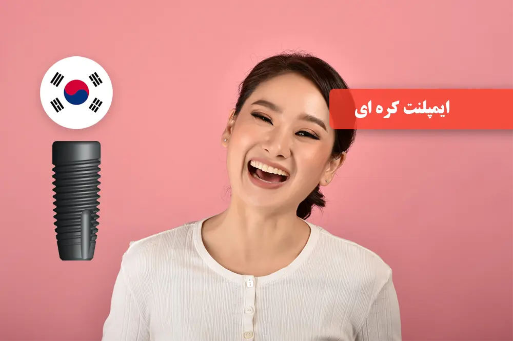 قیمت و کیفیت ایمپلنت کرهای سیز (Cis) در ایران