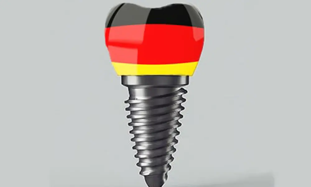 ایمپلنت آلمانی ریتر (Ritter)؛ کیفیت، دوام و تکنولوژی روز