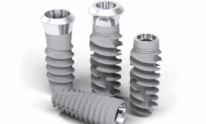 قیمت ایمپلنت برندهای معروف (اشترومن، نئودنت، آلمانی، کره‌ای) در تهران