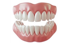 قیمت ایمپلنت دندان در تهران ۱۴۰۴،راهنمای کامل