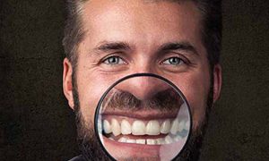 راهنمای انتخاب کلینیک ایمپلنت برای ساکنان تهرانپارس